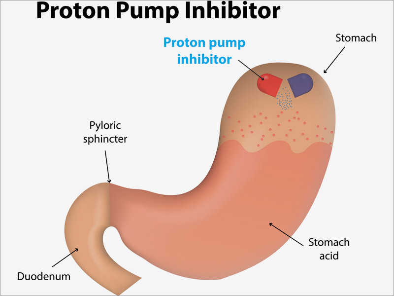 what is ppi proton pump inhibitor